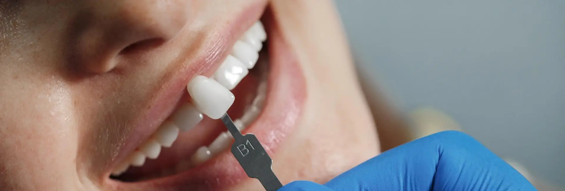 Bareq Zircon Elite Hollywood smile