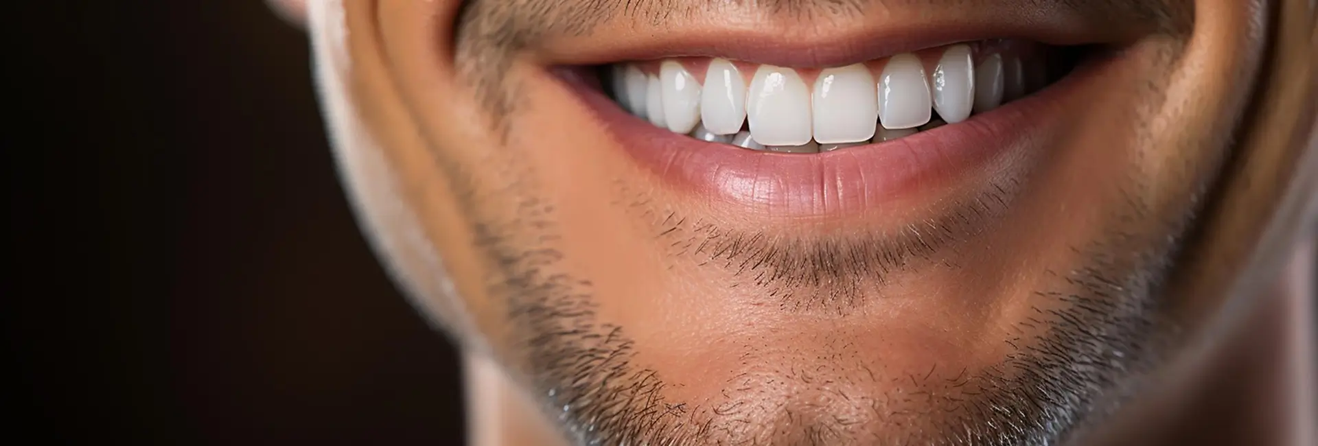 Bareq Zircon Hollywood smile