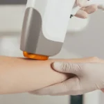 Candela GentleMax Pro