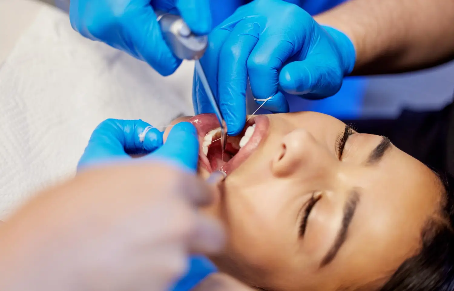 Dental Surgical Treatment3