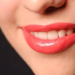 E-Max Hollywood smile Group