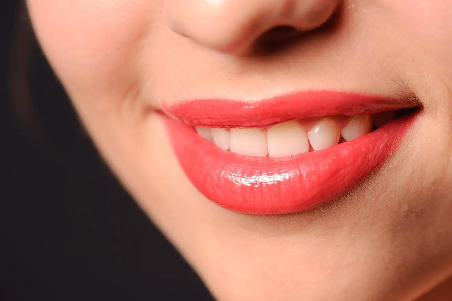 Basic MO Premium Smile