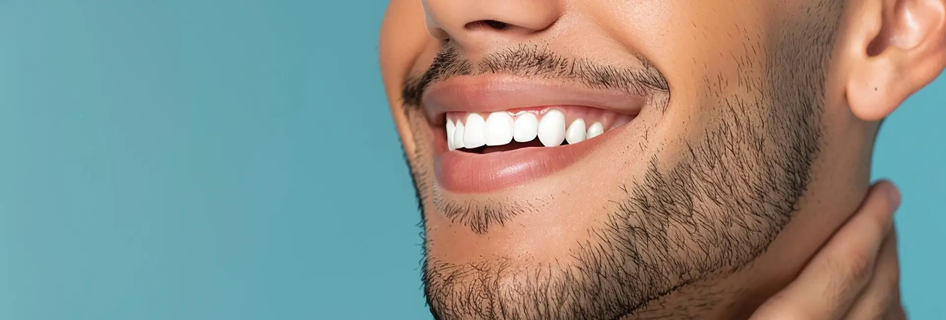 GC - Snow white Hollywood smile