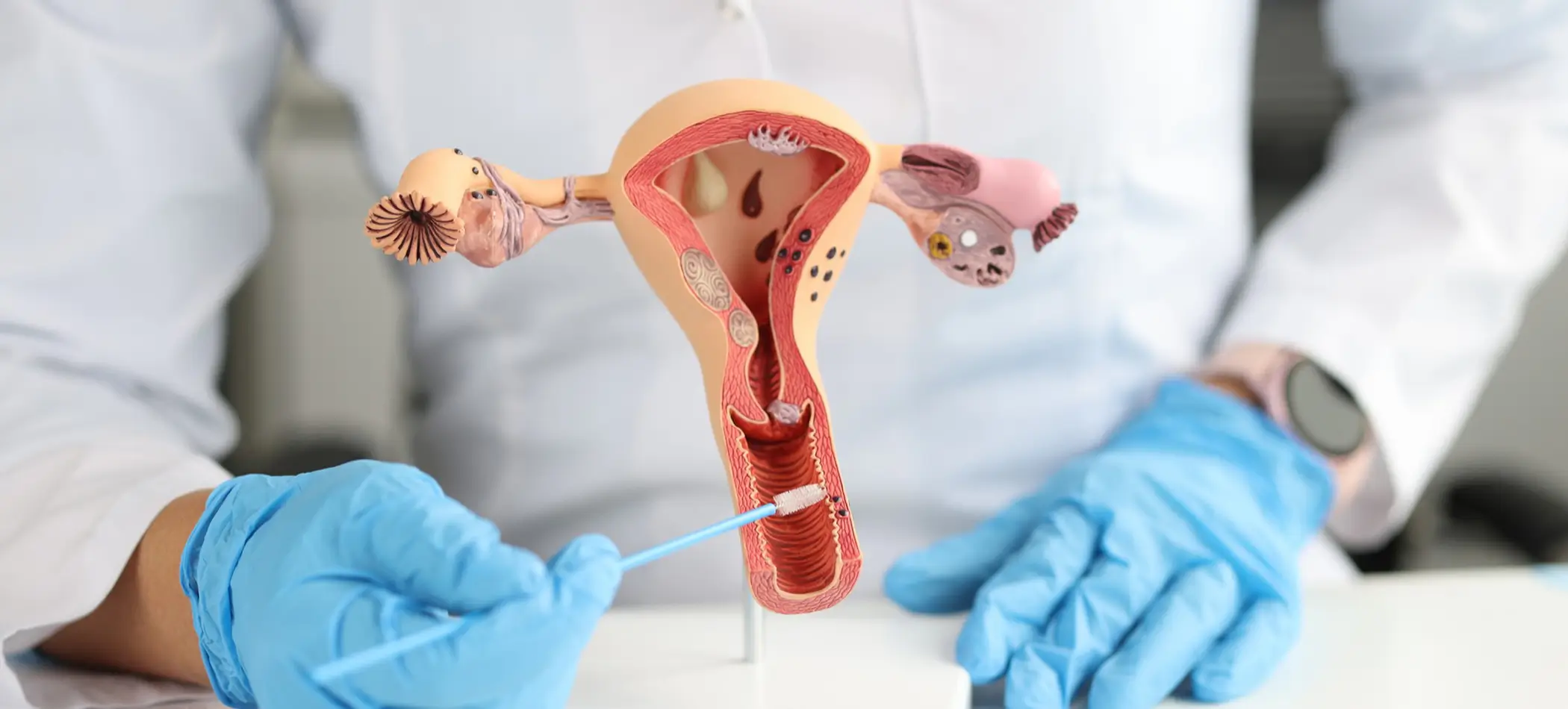 Gynecological filler