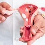 Gynecology Aesthetic