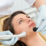 HydraFacial