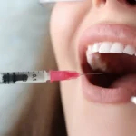 Oral Health (Gum Treatment)