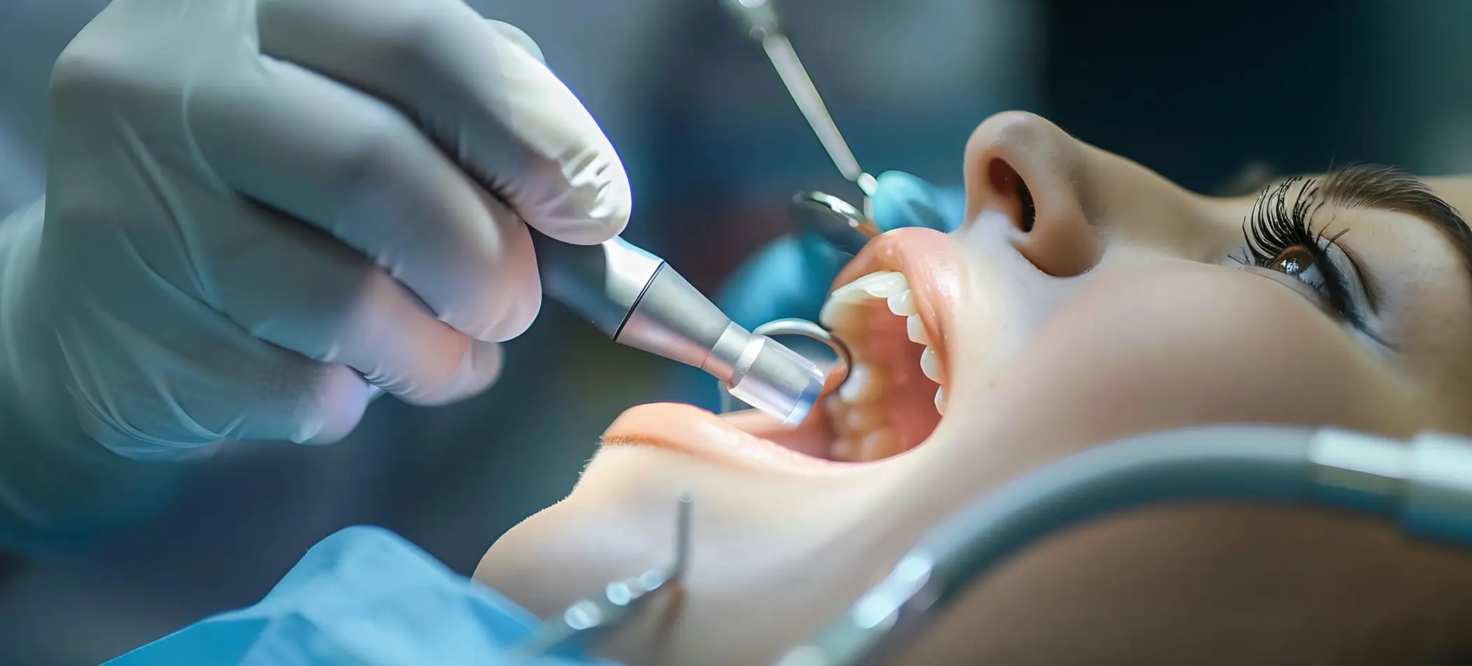 Root Canal Treatment
