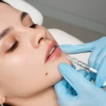 derma-filler