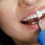 teeth-implant-thumbnail