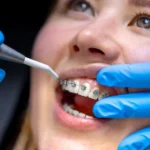 teeth-orthodontics-2