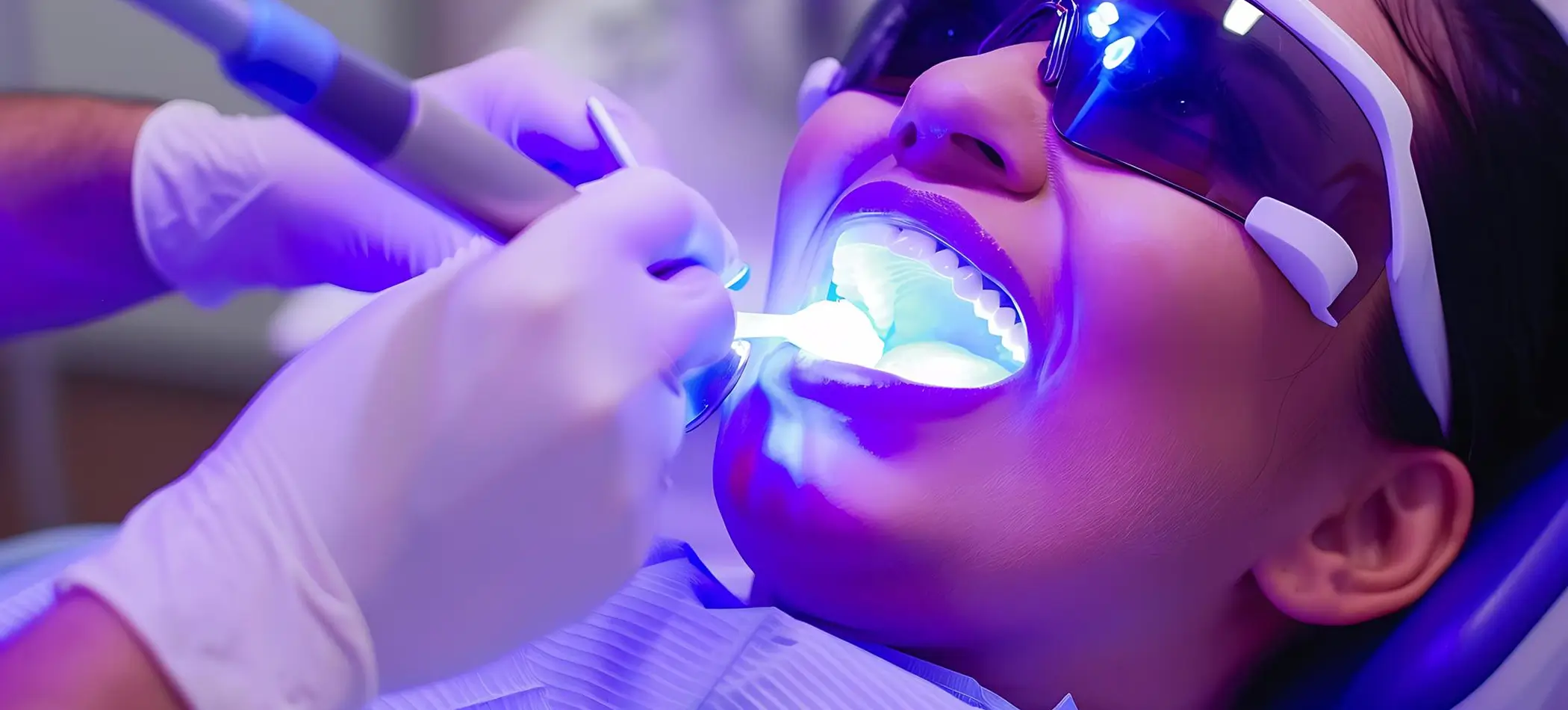 Teeth Whitening